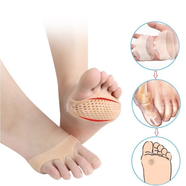 Coussinets D'Avant- Pied -Gel Silicone -Pour Soulagement De La Douleur - Beige